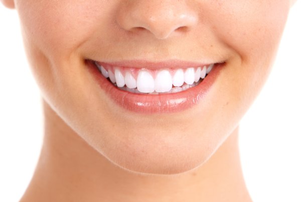 Dental Veneers