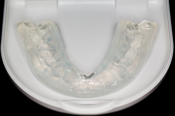 Invisalign Dentist