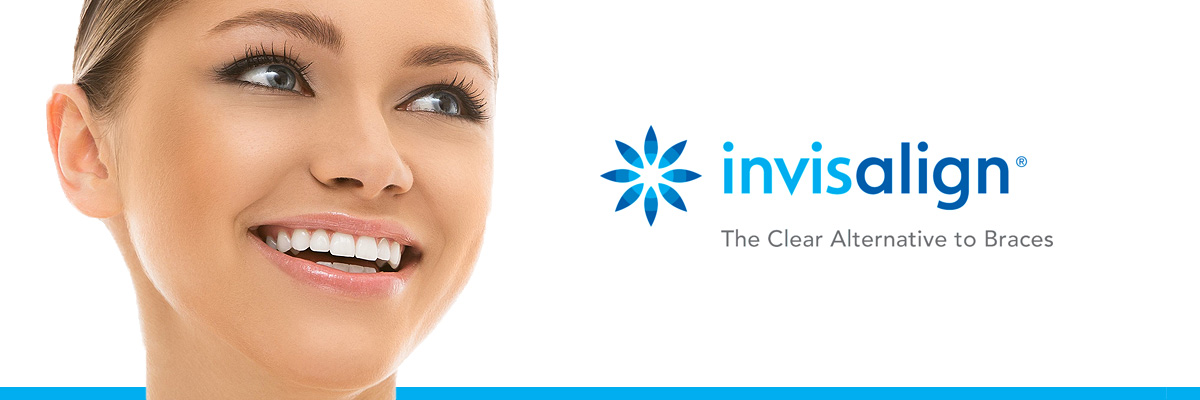 invisalign-for-teens-header