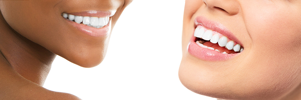 Teeth Whitening Brooklyn NY - Teeth Bleaching - Dental Whitening